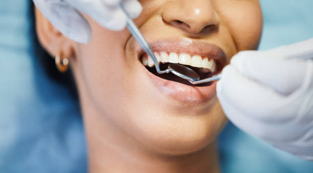 Best Urgent Tooth Repair  in Assumption, IL